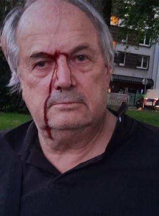 Polizeigewalt gegen Anwalt Roland Meister
